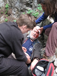 Scalp Laceration
